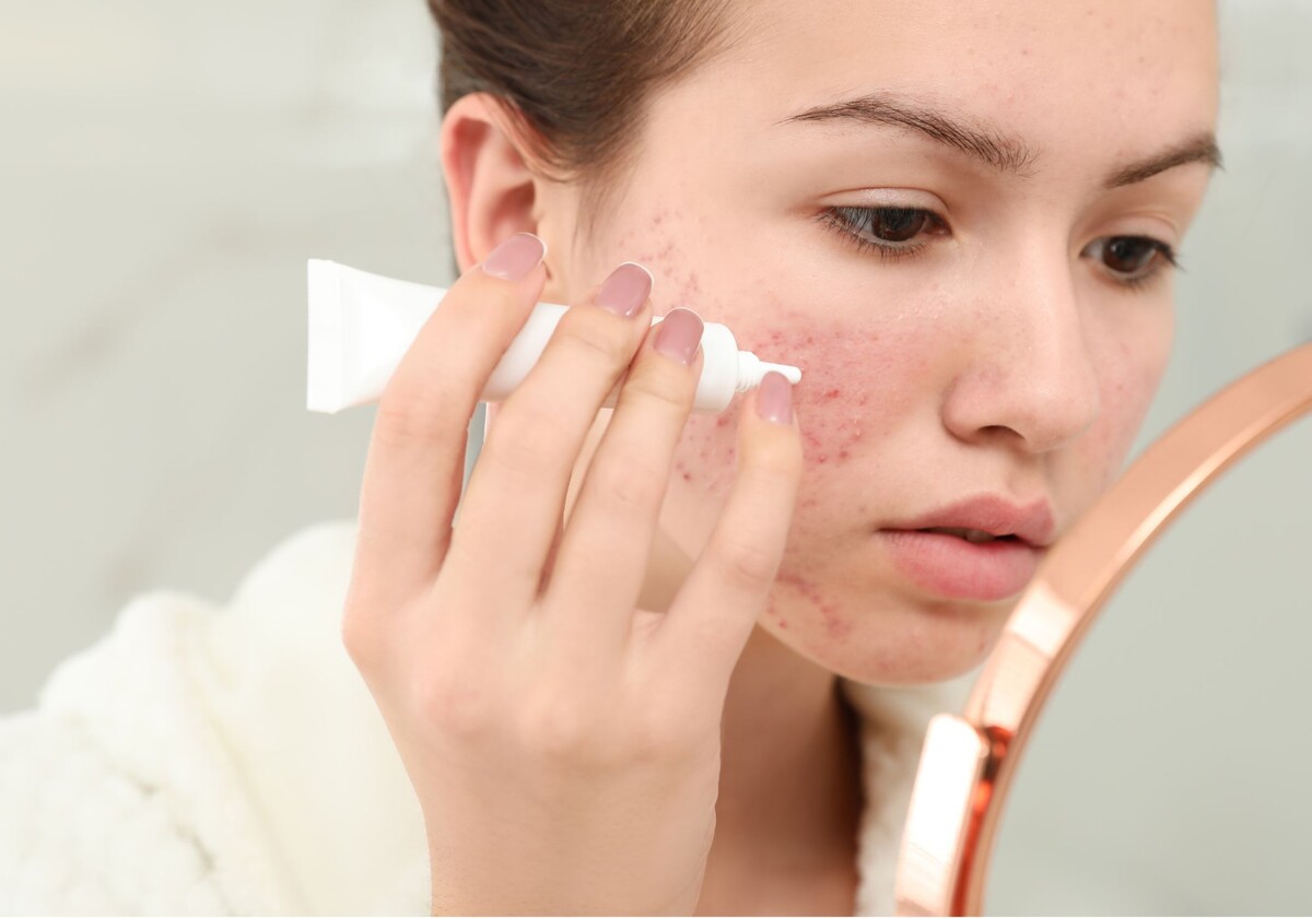 Dr. Lana Mieze - Acne vulgaris. Ieskats šī brīža rekomendācijās